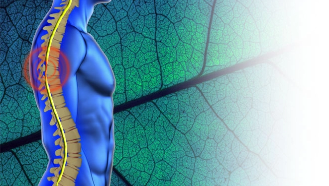 Sırtta Kanal Daralması Tedavisi