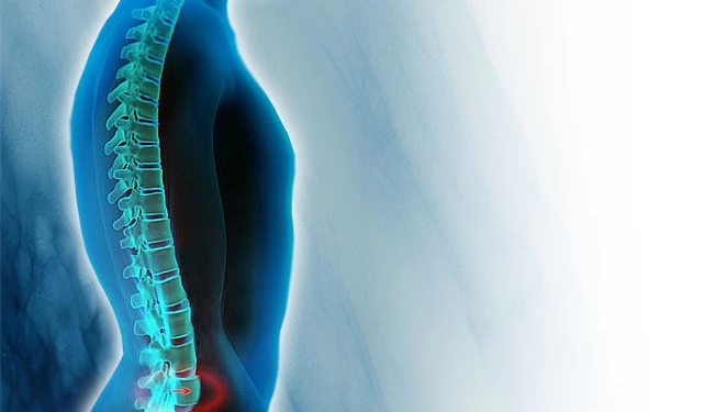 Bel ve Boyun Kaymaları