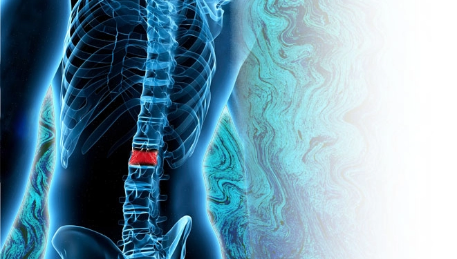 Omurga ve Omurilik Tümörleri